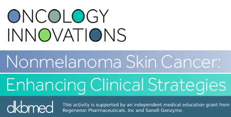 Nonmelanoma Skin Cancer: Enhancing Clinical Strategies